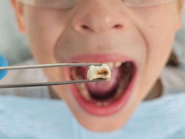 Best Walk-In Emergency Dental Services in Brookfield Center, OH