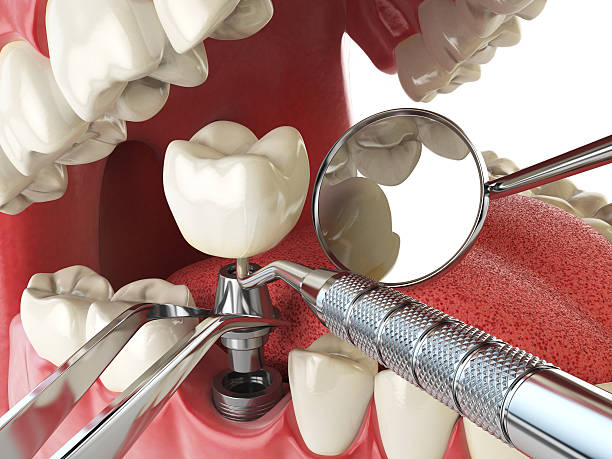 Best Emergency Treatment for Jaw Pain or Injury in Brookfield Center, OH